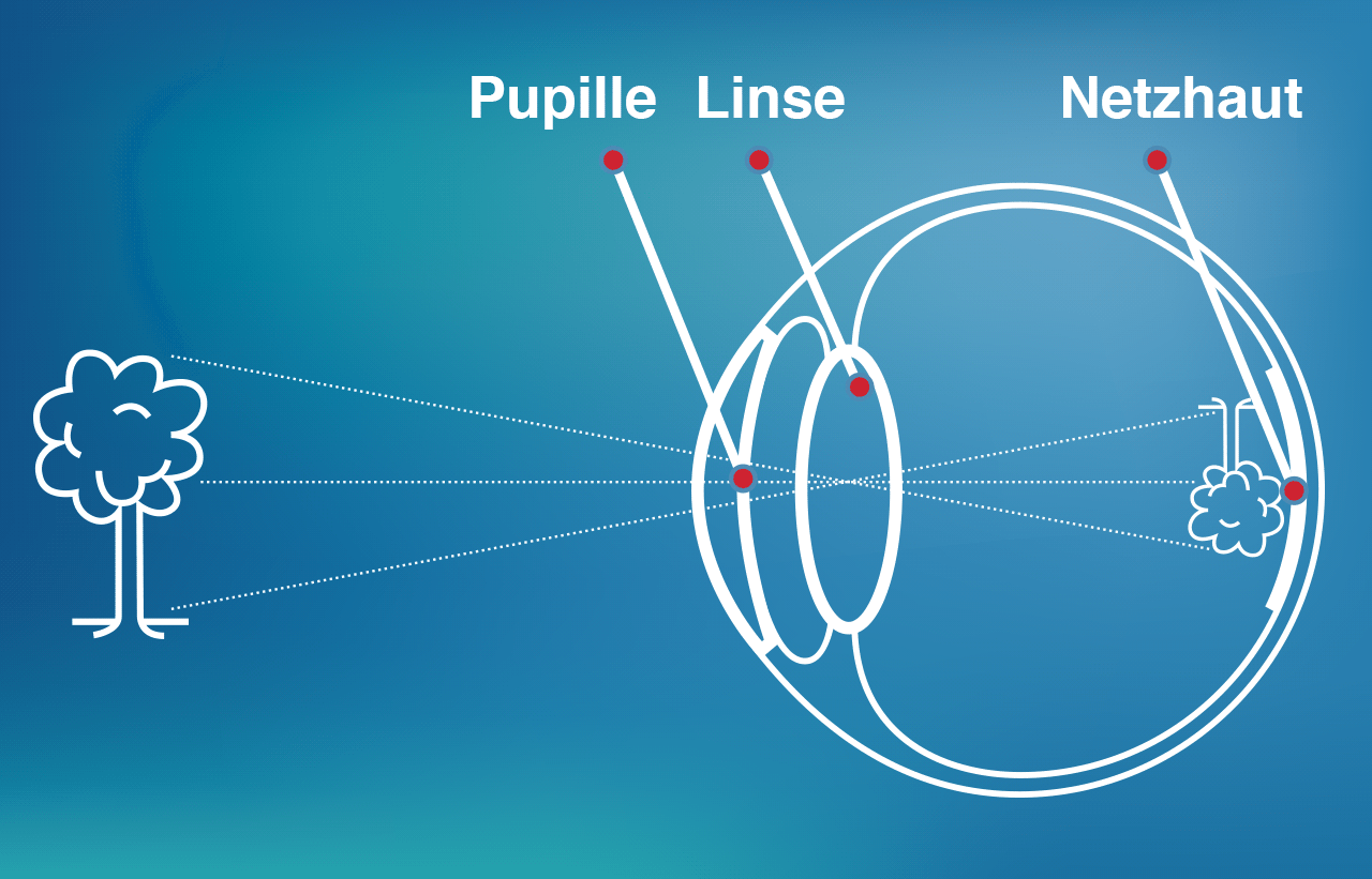 Auge Optik