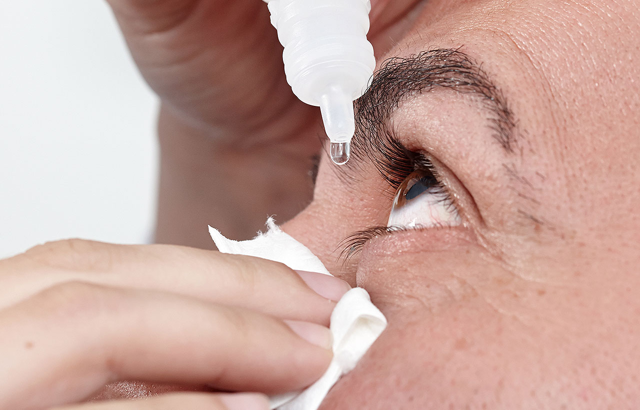 Pupillenerweiterung mit Augentropfen zur Untersuchung