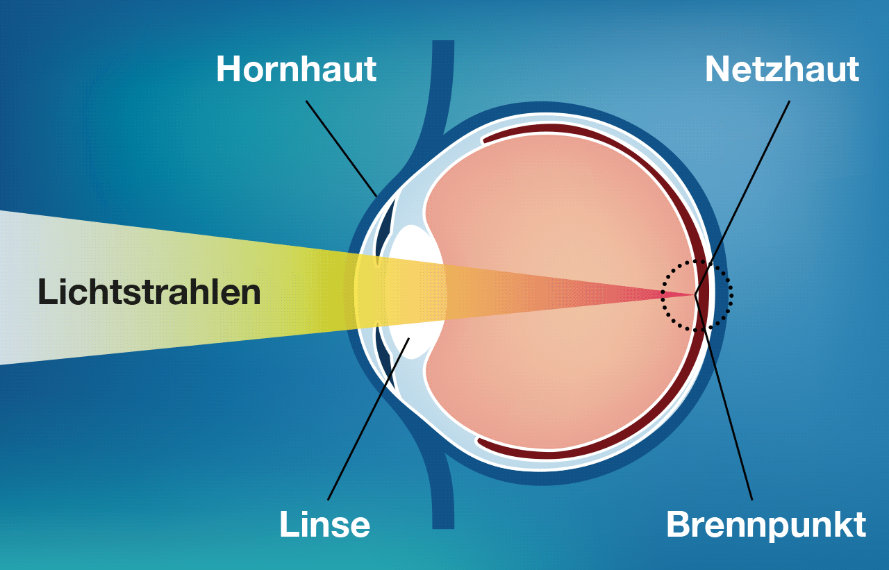 Normalsichtigkeit Grafik