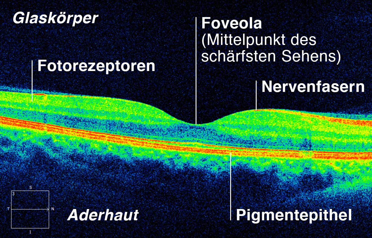 OCT Netzhaut Scan