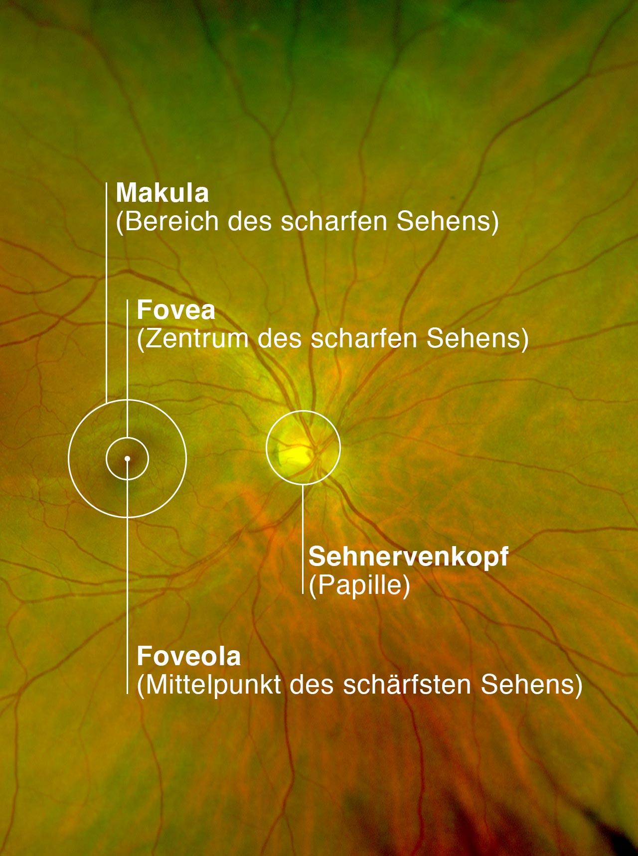 optomap Abbildung der Netzhaut